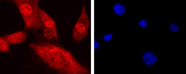 CTCF Antibody in Immunocytochemistry (ICC/IF)