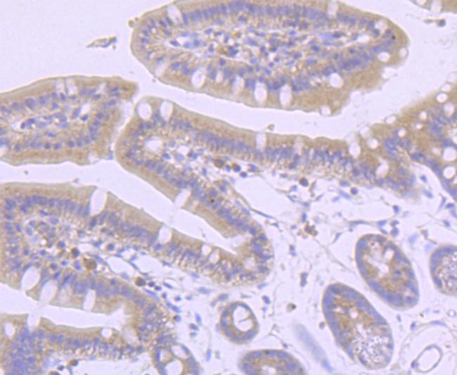 AXIN2 Antibody in Immunohistochemistry (Paraffin) (IHC (P))