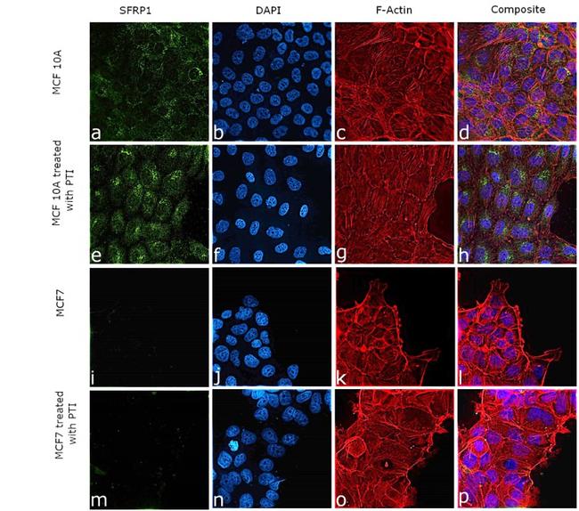 SFRP1 Antibody in Immunocytochemistry (ICC/IF)