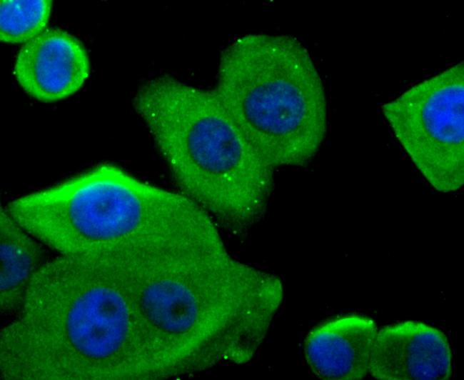 G6PD Antibody in Immunocytochemistry (ICC/IF)