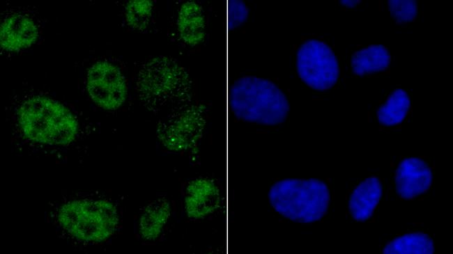 hnRNP A1 Antibody in Immunocytochemistry (ICC/IF)