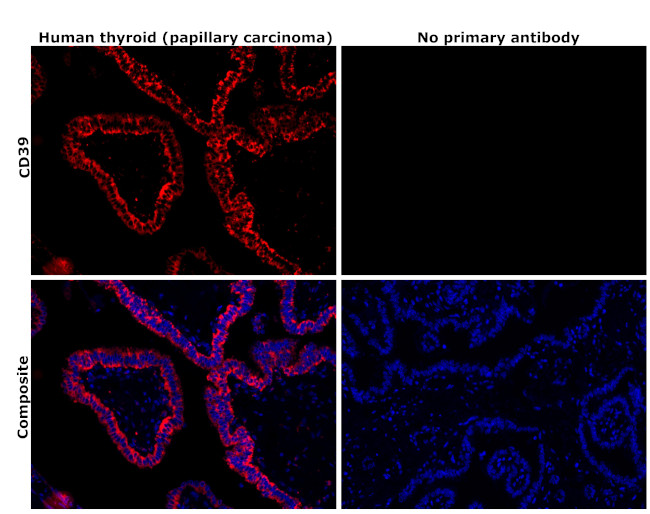 CD39 Antibody in Immunohistochemistry (Paraffin) (IHC (P))