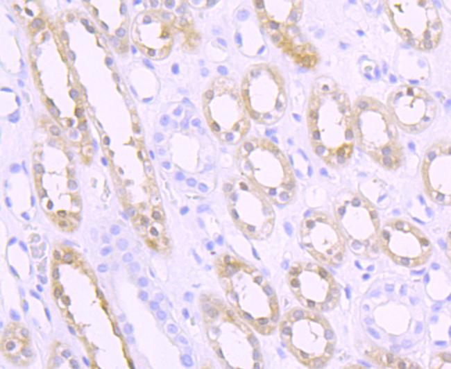 SPHK1 Antibody in Immunohistochemistry (Paraffin) (IHC (P))