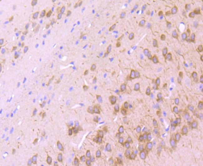 IP3 Receptor 1 Antibody in Immunohistochemistry (Paraffin) (IHC (P))