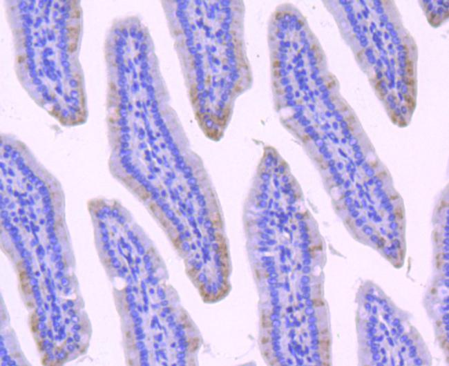 NMDAR2A Antibody in Immunohistochemistry (Paraffin) (IHC (P))