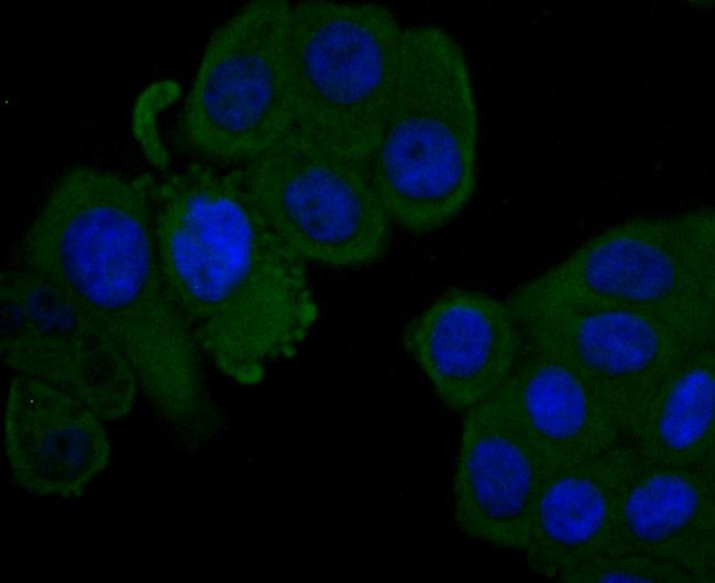 Complement Factor H Antibody in Immunocytochemistry (ICC/IF)