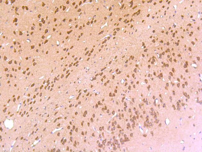 HTR2C Antibody in Immunohistochemistry (Paraffin) (IHC (P))