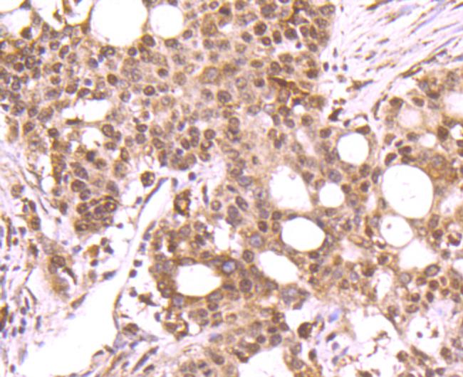 POLB Antibody in Immunohistochemistry (Paraffin) (IHC (P))