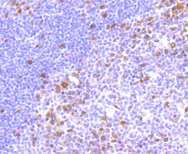 Thymidylate Synthase Antibody in Immunohistochemistry (Paraffin) (IHC (P))