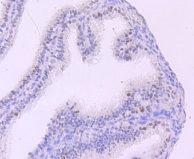 MYST2 Antibody in Immunohistochemistry (Paraffin) (IHC (P))