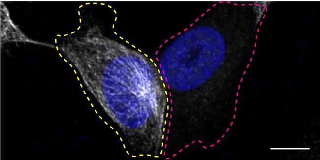 TUBA4A Antibody in Immunocytochemistry (ICC/IF)