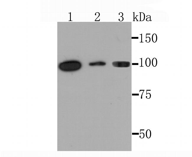 PKC mu Antibody in Western Blot (WB)