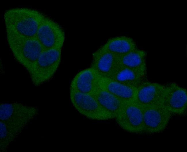 NFkB p100 Antibody in Immunocytochemistry (ICC/IF)