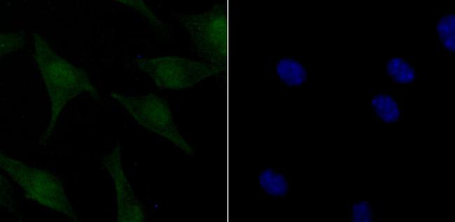 Phospho-ATM (Ser1981) Antibody in Immunocytochemistry (ICC/IF)