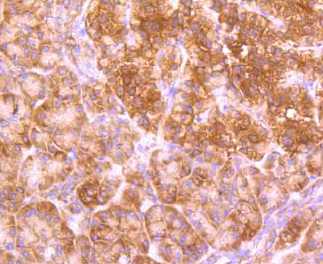 GABARAP/GABARAPL1 Antibody in Immunohistochemistry (Paraffin) (IHC (P))