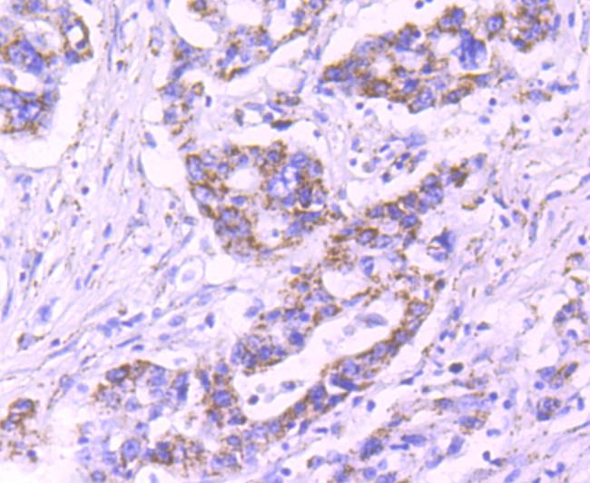 PDHB Antibody in Immunohistochemistry (Paraffin) (IHC (P))