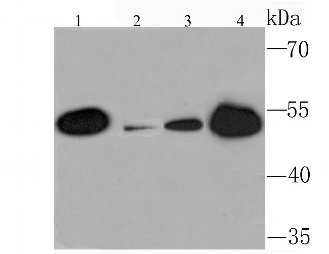 SETD8 Antibody in Western Blot (WB)