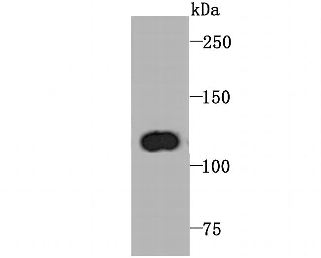 PPARGC1B Antibody in Western Blot (WB)