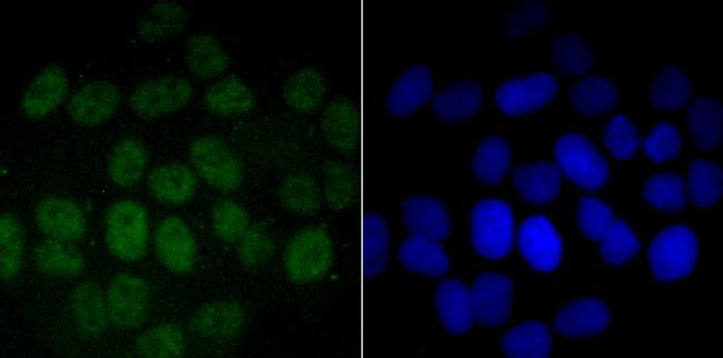 PFKFB3 Antibody in Immunocytochemistry (ICC/IF)