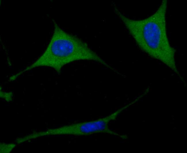 TXNIP Antibody in Immunocytochemistry (ICC/IF)