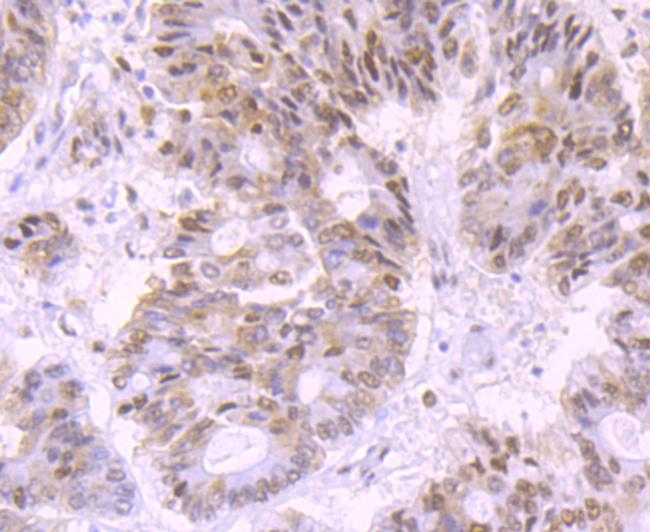 DNA ligase IV Antibody in Immunohistochemistry (Paraffin) (IHC (P))