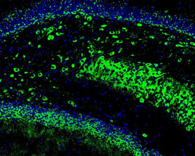 GCLM Antibody in Immunocytochemistry (ICC/IF)