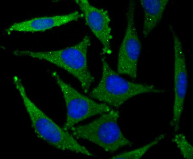 GluR2 Antibody in Immunocytochemistry (ICC/IF)