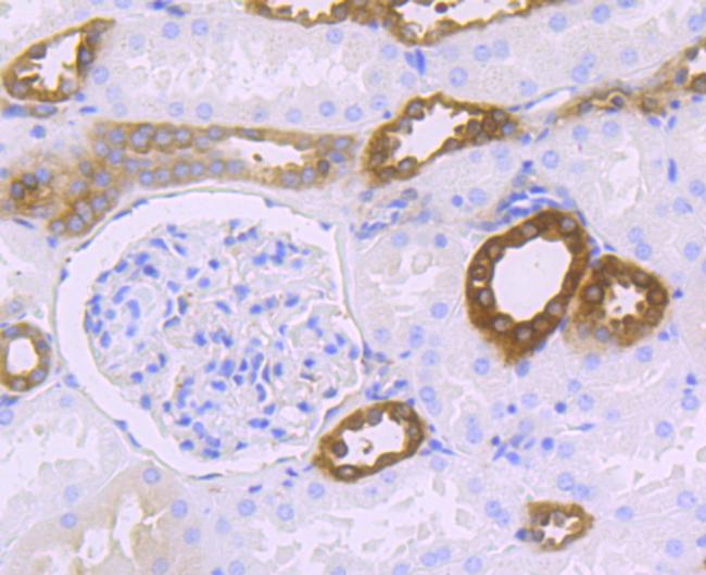 HPRT1 Antibody in Immunohistochemistry (Paraffin) (IHC (P))