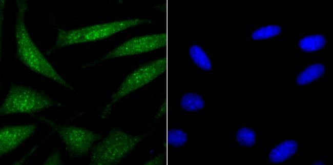 USP22 Antibody in Immunocytochemistry (ICC/IF)