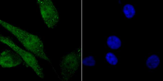 Histone Macro-H2A.1 Antibody in Immunocytochemistry (ICC/IF)