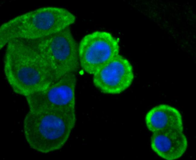 IKK epsilon Antibody in Immunocytochemistry (ICC/IF)