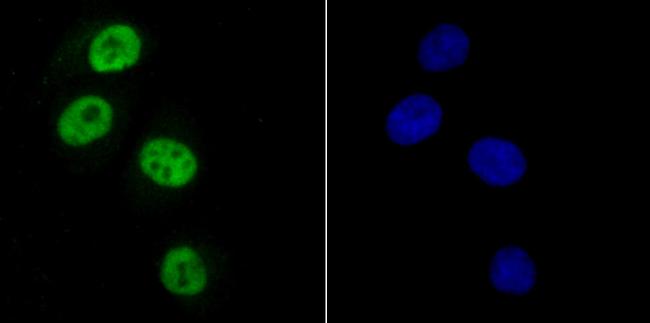 SAMHD1 Antibody in Immunocytochemistry (ICC/IF)