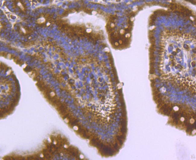 ATG3 Antibody in Immunohistochemistry (Paraffin) (IHC (P))