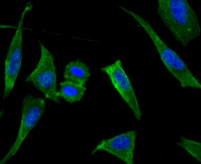 LOX Antibody in Immunocytochemistry (ICC/IF)