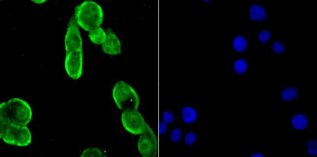 Drosha Antibody in Immunocytochemistry (ICC/IF)