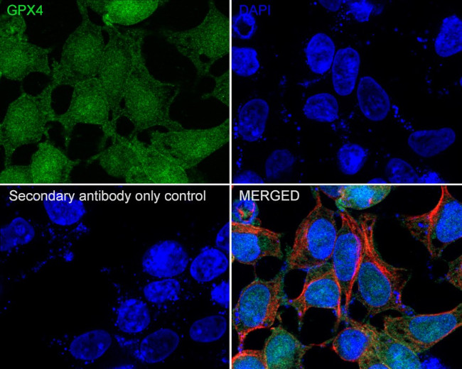 GPX4 Antibody in Immunocytochemistry (ICC/IF)