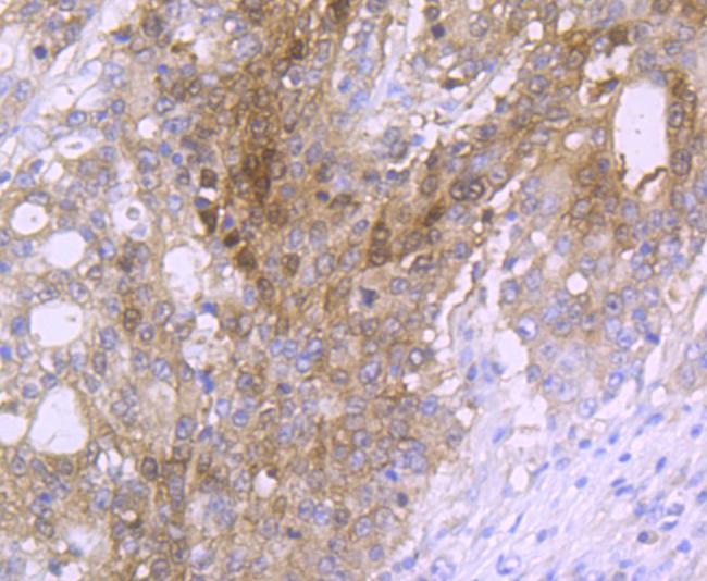 Carbonic anhydrase II Antibody in Immunohistochemistry (Paraffin) (IHC (P))