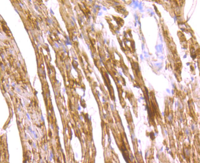 FABP3 Antibody in Immunohistochemistry (Paraffin) (IHC (P))