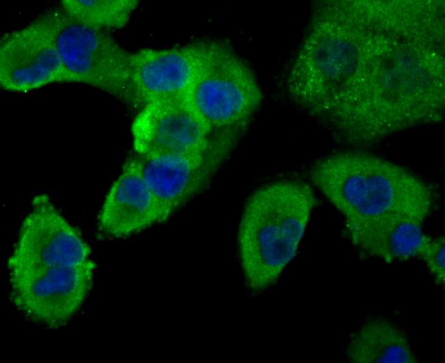 PCSK9 Antibody in Immunocytochemistry (ICC/IF)