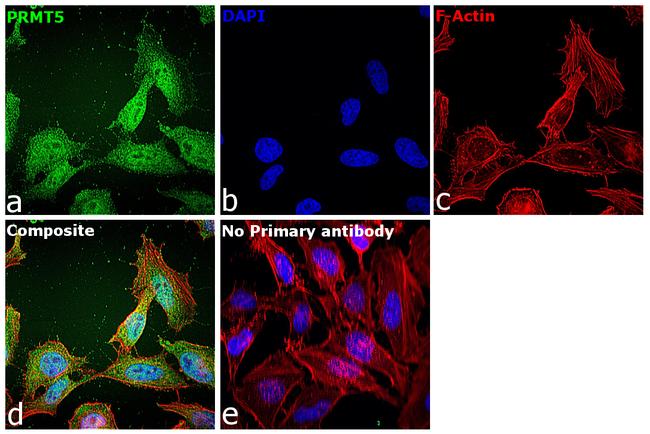 PRMT5 Antibody in Immunocytochemistry (ICC/IF)