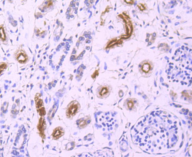 GCLC Antibody in Immunohistochemistry (Paraffin) (IHC (P))