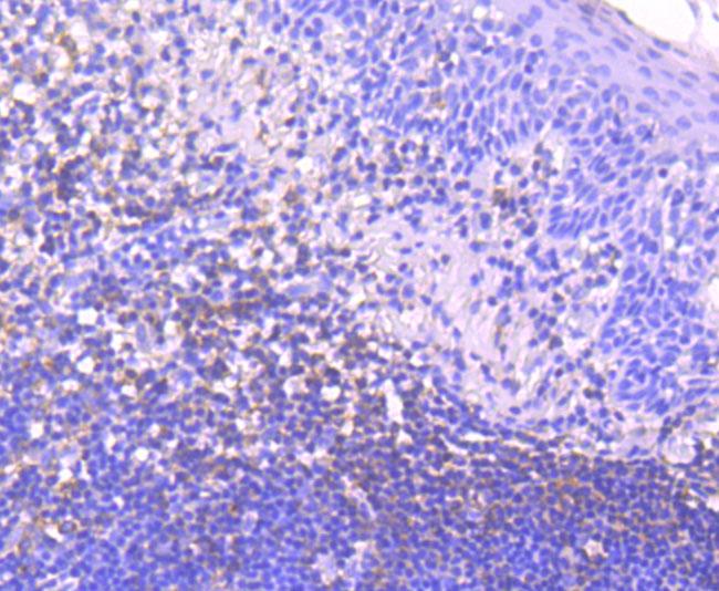 IkB epsilon Antibody in Immunohistochemistry (Paraffin) (IHC (P))