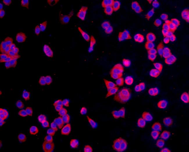 CCDC47 Antibody in Immunocytochemistry (ICC/IF)