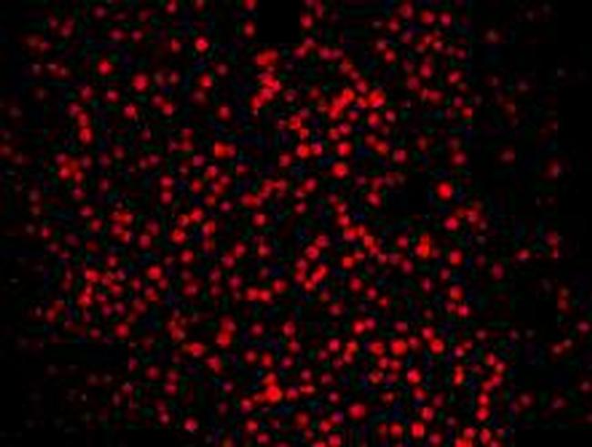 Lass2 Antibody in Immunocytochemistry (ICC/IF)