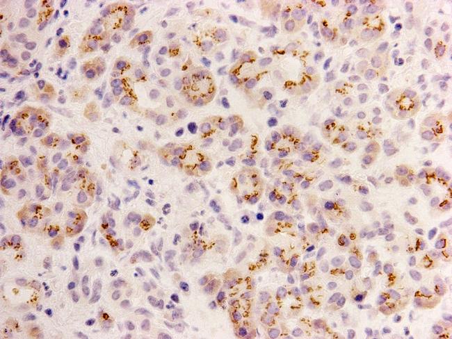 ID2 Antibody in Immunohistochemistry (Paraffin) (IHC (P))