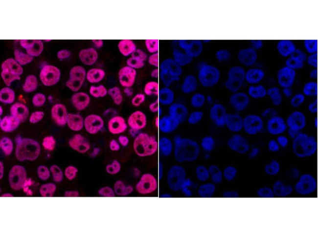 DPY30 Antibody in Immunocytochemistry (ICC/IF)