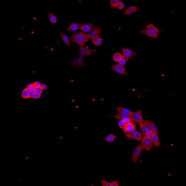 CDK2 Antibody in Immunocytochemistry (ICC/IF)