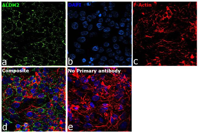 ALDH2 Antibody in Immunocytochemistry (ICC/IF)