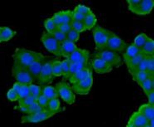 ESD Antibody in Immunocytochemistry (ICC/IF)