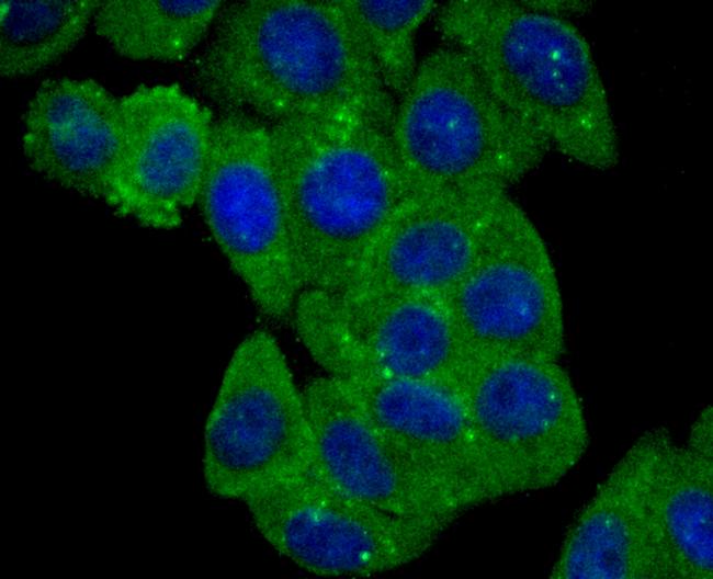 BLCAP Antibody in Immunocytochemistry (ICC/IF)